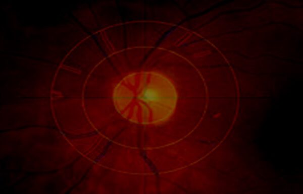 Rhein Augenzentrum Dr. Med. Anna Cybulska-heinrich Augenarztpraxis Anna Cybulska-Heinrich – Rhein Augenzentrum